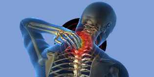 Cervical хондроз